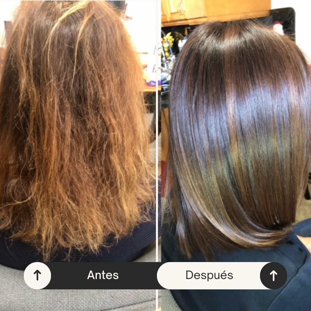 Advance Recovery Kit